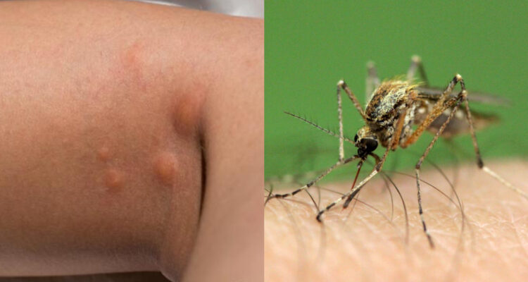 Vecinos alertan masiva presencia de zancudos en el Gran Concepción