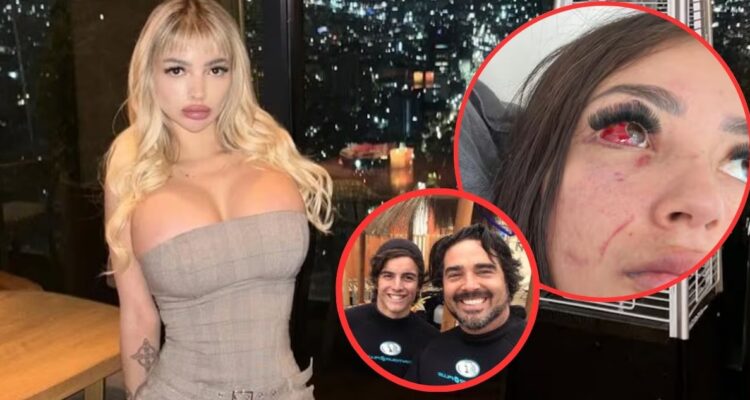 “Quería matarme”: Gatita Veve revela imágenes de supuesta agresión por parte de hijo de Pancho López