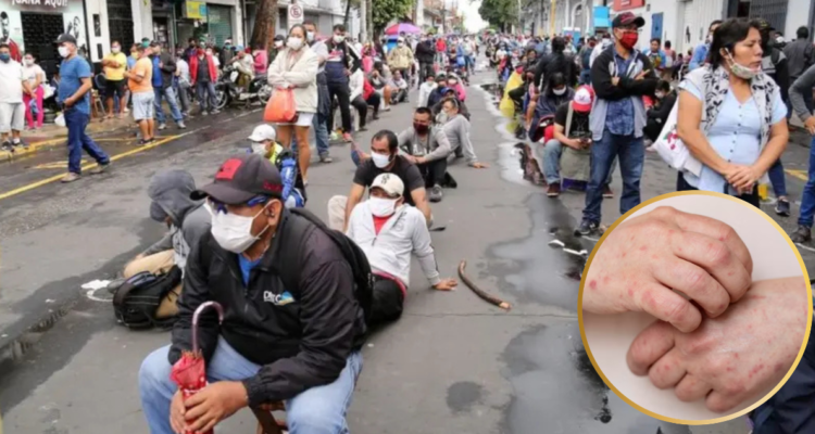Brote de sarampión en Perú