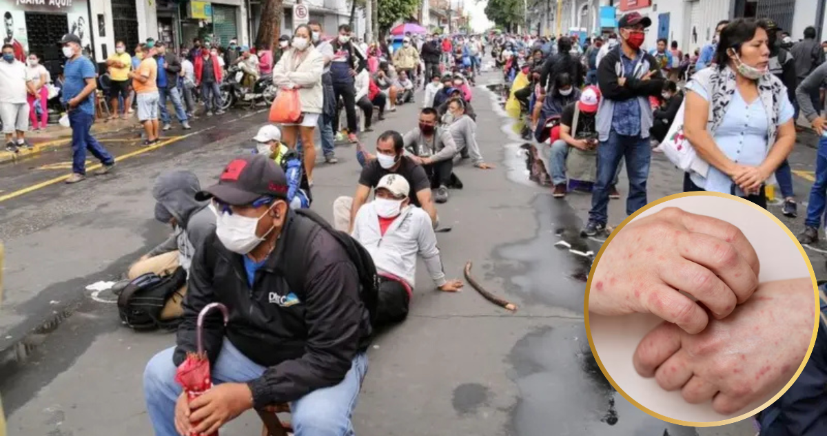 Brote de sarampión en Perú