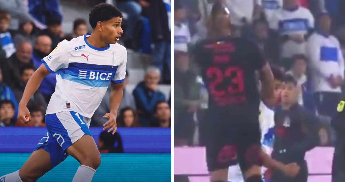 Juan Francisco Rossel debió ser operado tras golpe de Arturo Vidal.