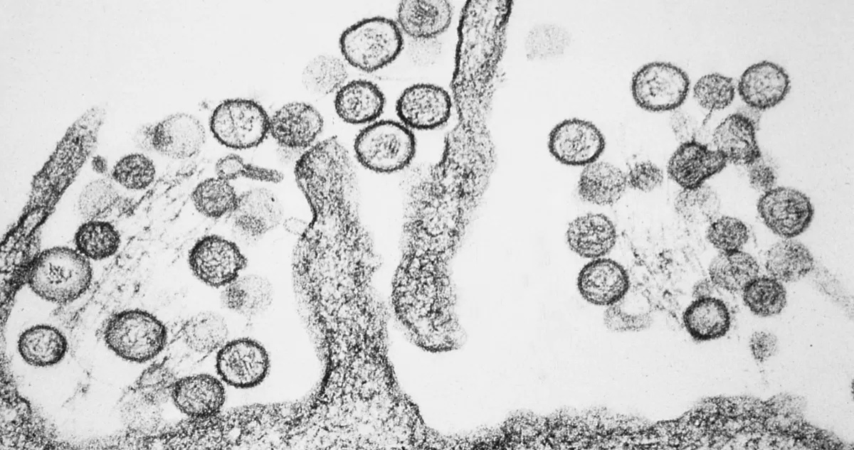Chile registra 39 casos de hantavirus en lo que va de 2026 con aumento en la letalidad
