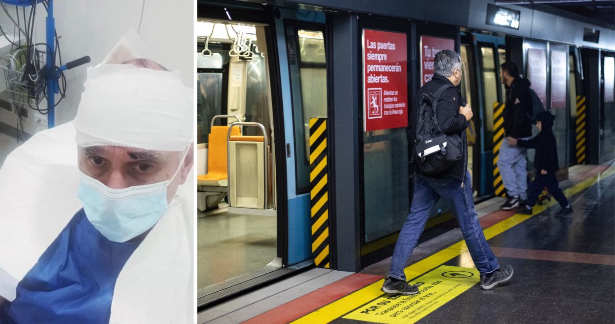 “Agresión por la espalda”: Conocido locutor denuncia secuelas de grave golpiza que recibió en el Metro