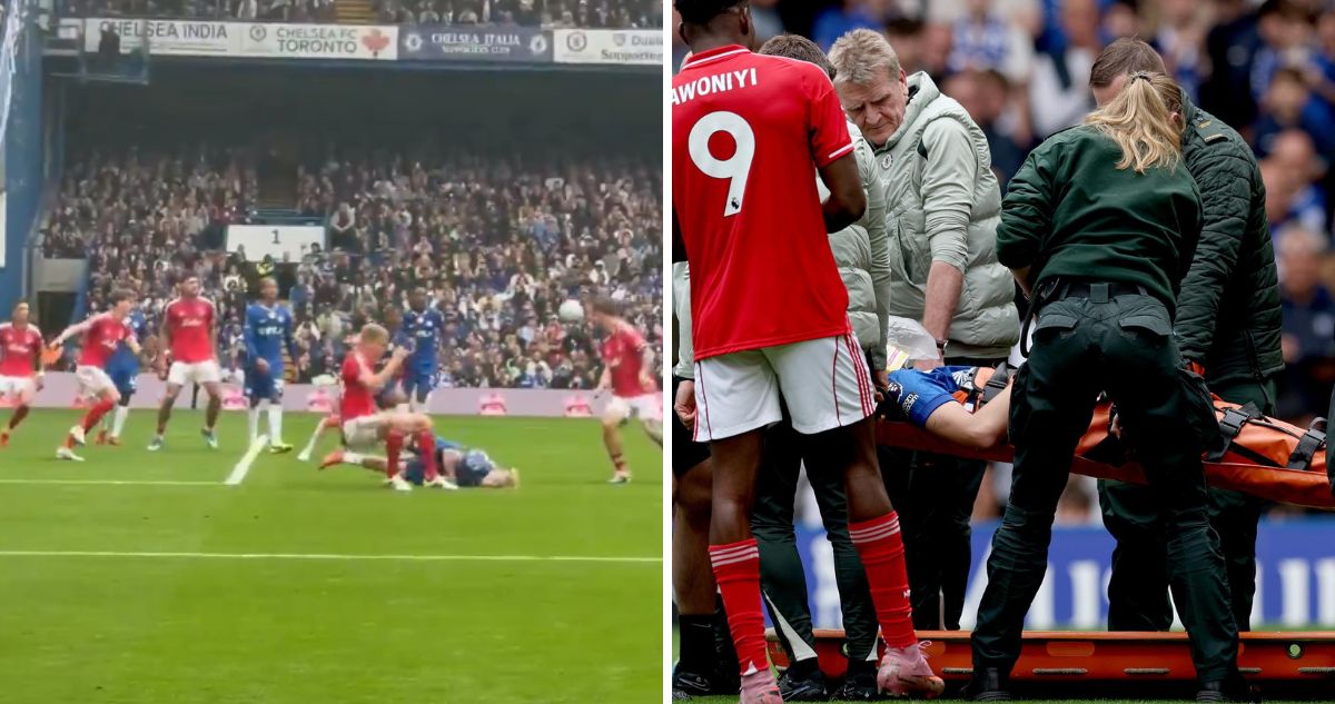 Jesse Derry sufrió brutal choque de cabezas en su debut con Chelsea.