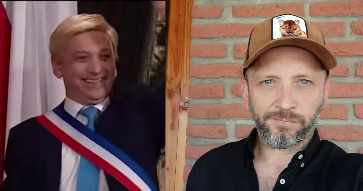 Actor que imita a Kast en el Club de la Comedia actualizó complejo estado de “oclusión intestinal”