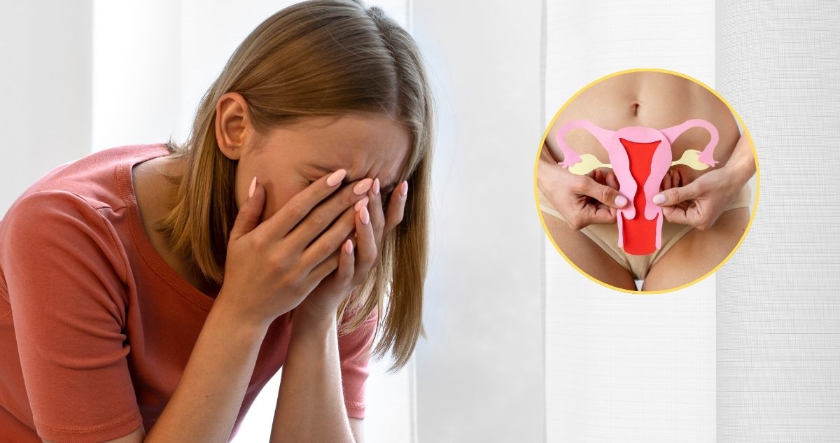 Las razones médicas por la que el síndrome de ovario poliquístico (SOP) ya no se llama así