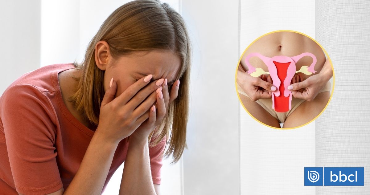 Las razones médicas por las que el síndrome de ovario poliquístico (SOP) ya no se llama así