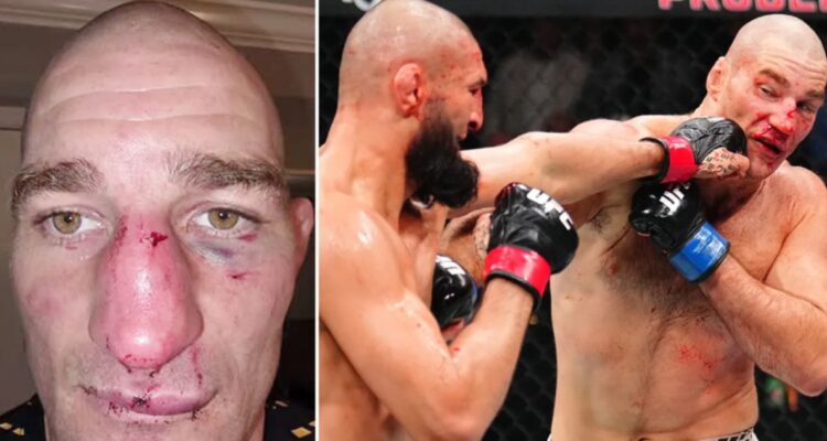Sean Strickland muestra lesión tras superar a Khamzat Chimaev en UFC 328