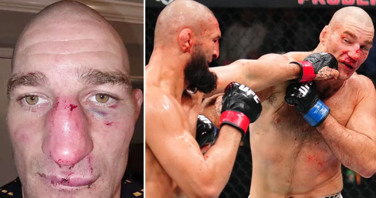 Sean Strickland muestra lesión tras superar a Khamzat Chimaev en UFC 328