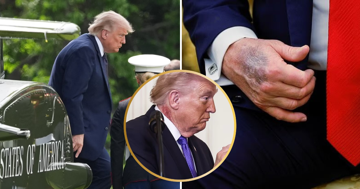 Trump se somete a chequeo de salud