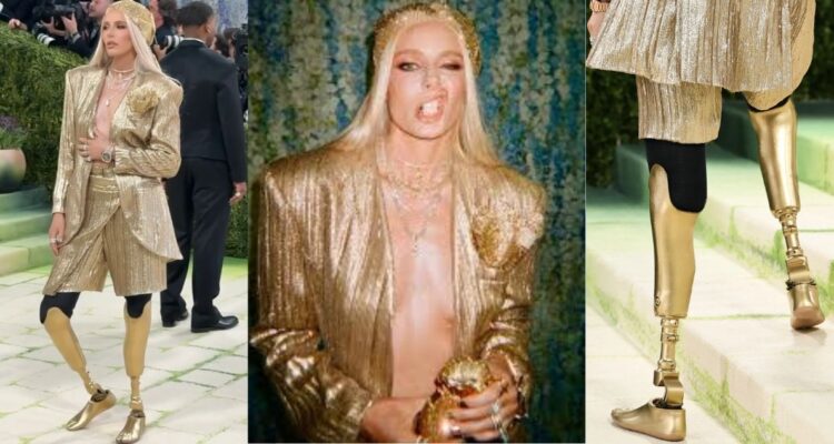 Modelo perdió sus piernas por culpa de un tampón, se reinventó y estuvo en la Met Gala 2026
