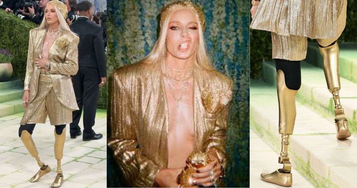Modelo perdió sus piernas por culpa de un tampón, se reinventó y estuvo en la Met Gala 2026