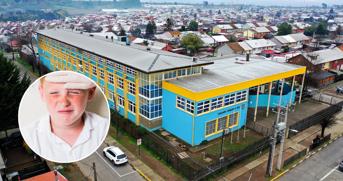 Detectan brote de eritema infeccioso en colegio municipal de Victoria: más de 10 menores afectados