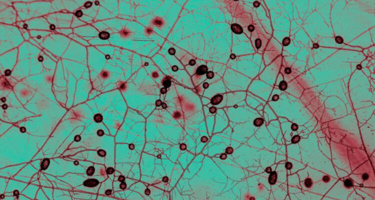 Hongos micorrícicos en microscopio para ilustrar nota sobre la enorme red de hongos oculta dentro de la Tierra