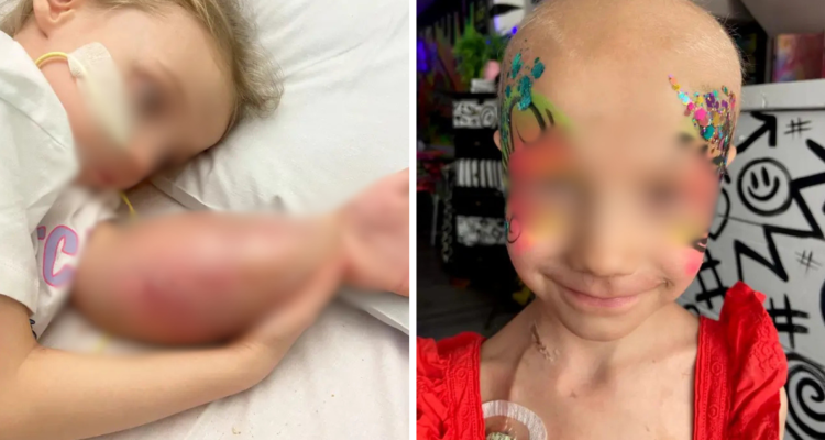 Pensaron que su hija sufrió esguince en su brazo y resultó ser cáncer