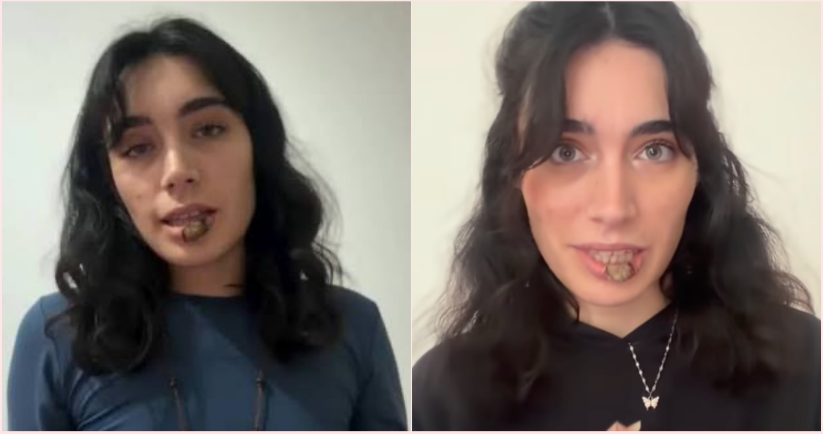 La historia de la joven que descubrió que tenía sífilis tras morderse un labio (y se volvió viral)