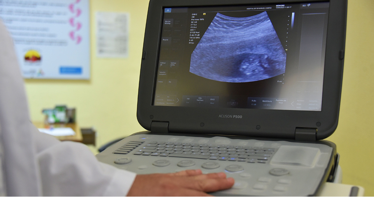 66% está en desacuerdo con proyecto que exige a mujeres oír latidos antes de abortar, según Cadem