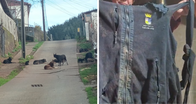 Hombre está hospitalizado tras sufrir brutal ataque de jauría de perros en Curanilahue