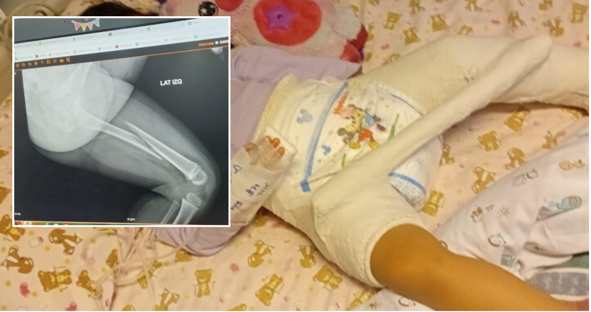 Integra deberá pagar millonaria indemnización por niña que se quebró fémur en jardín de La Araucanía
