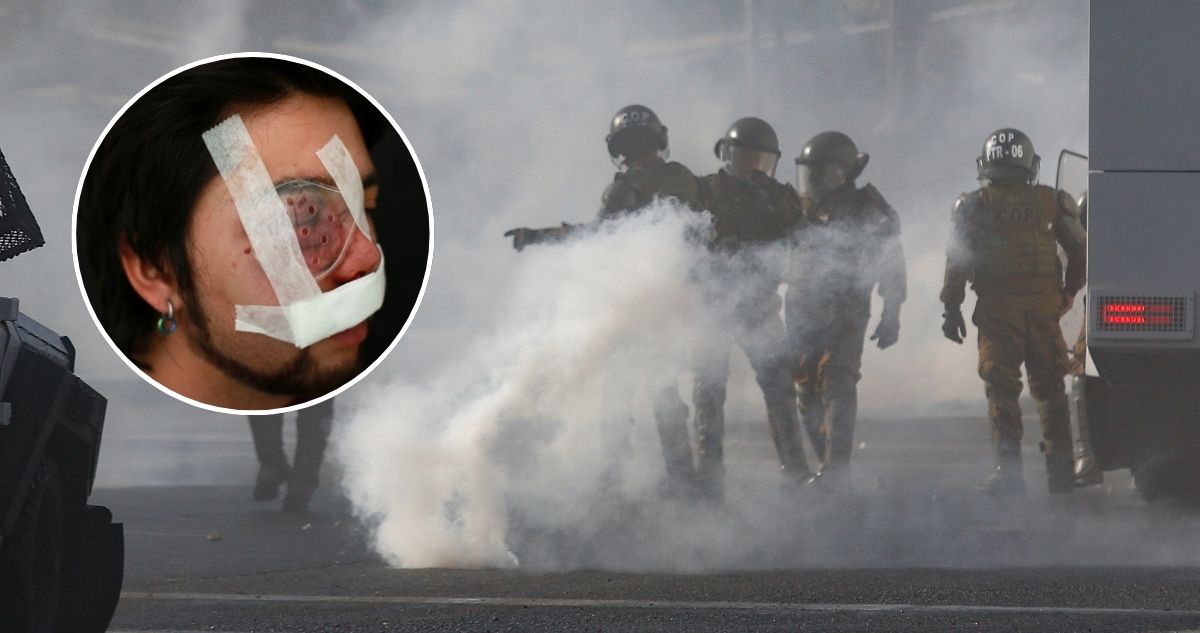 Millonaria indemnización para trabajador: perdió visión de ojo por lacrimógena lanzada por carabinero