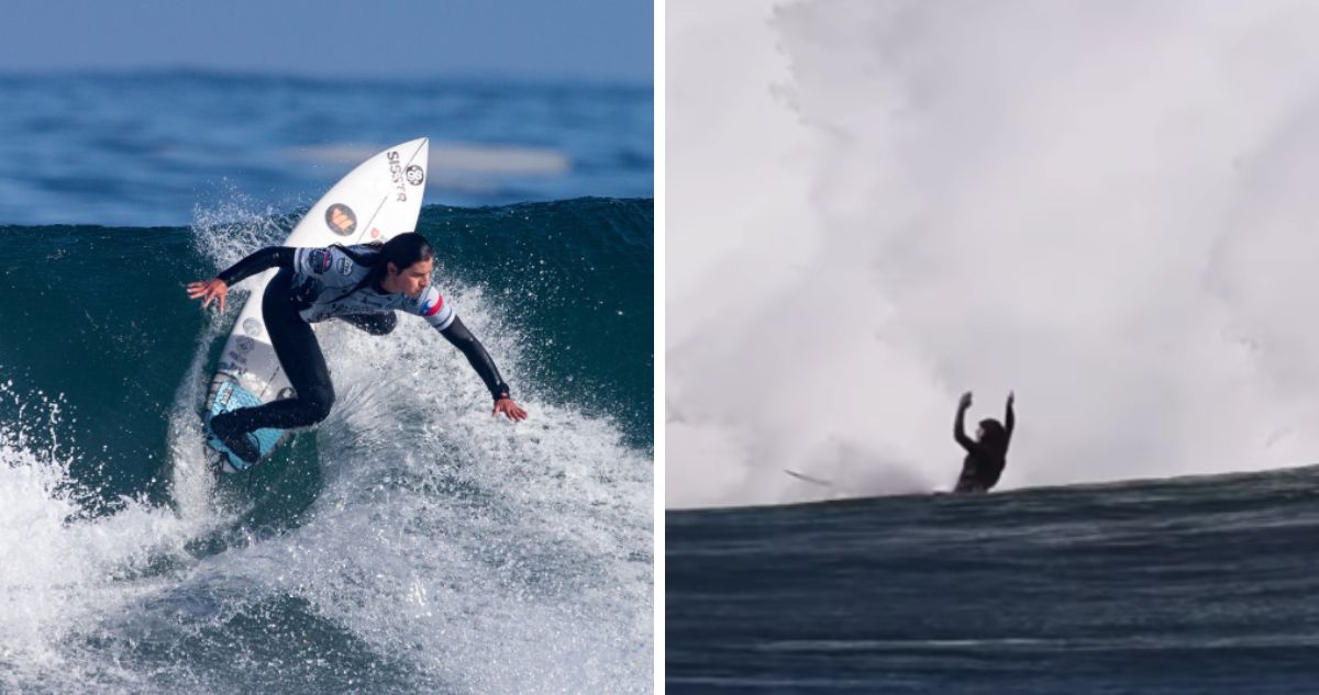 Surfista chilena sufre dura lesión en Punta de Lobos e inicia campaña para poder someterse a cirugía