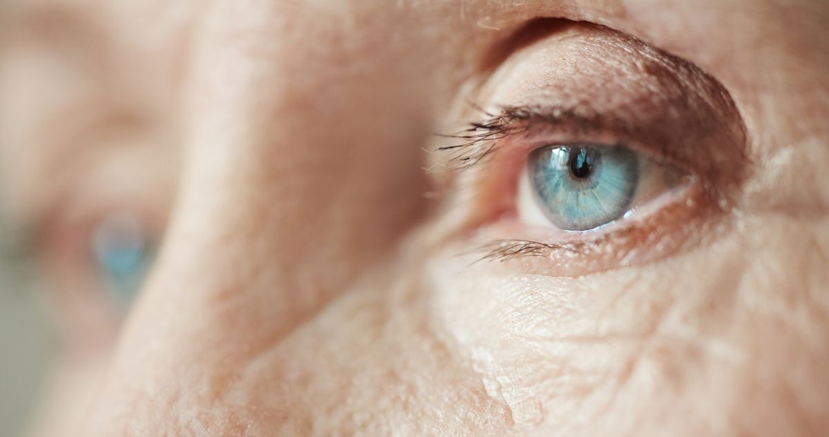 La edad no es la única causa de blefaroptosis: Por qué aparece y cuáles son sus tratamientos