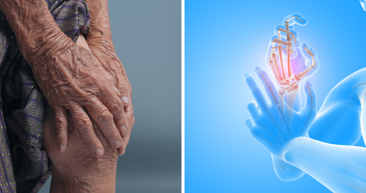 Terapia regenerativa con células madre