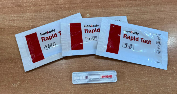 Científicos de la UACh desarrollan test rápido para hantavirus y anuncian entrega de 5 mil unidades