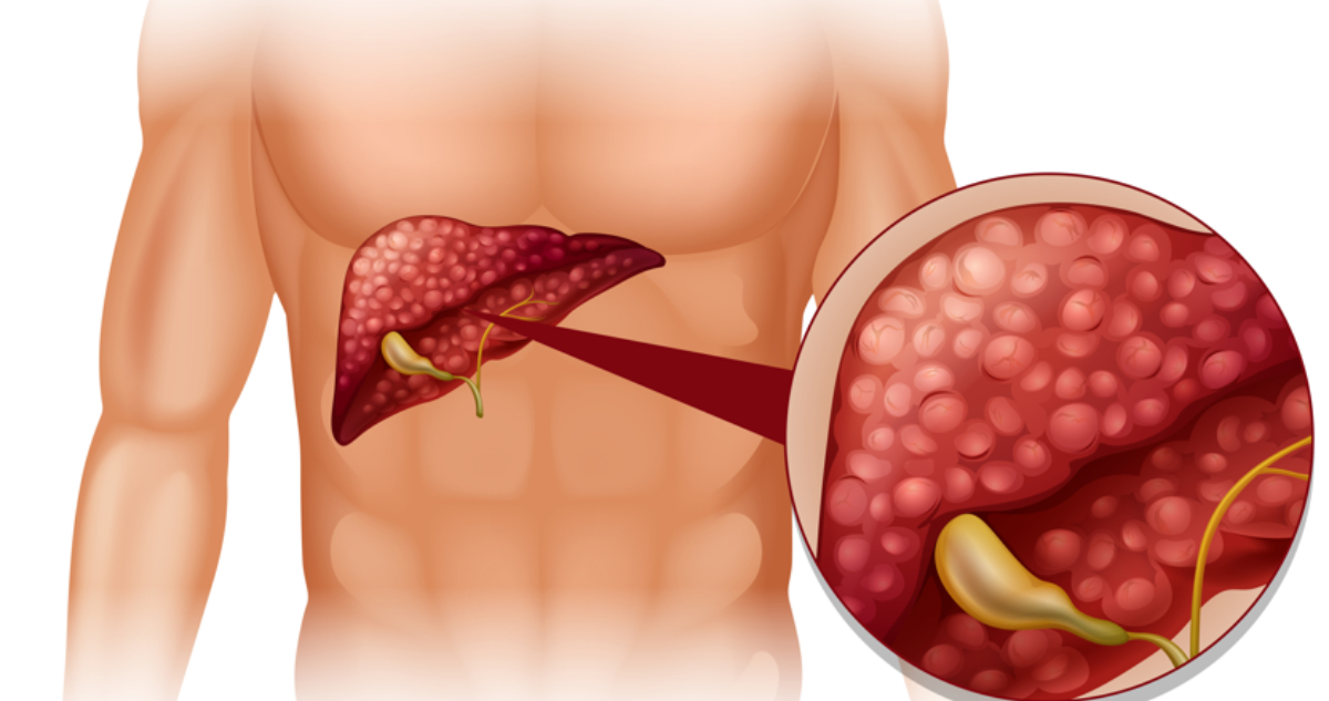 Imagen ilustrativa de la vesícula biliar