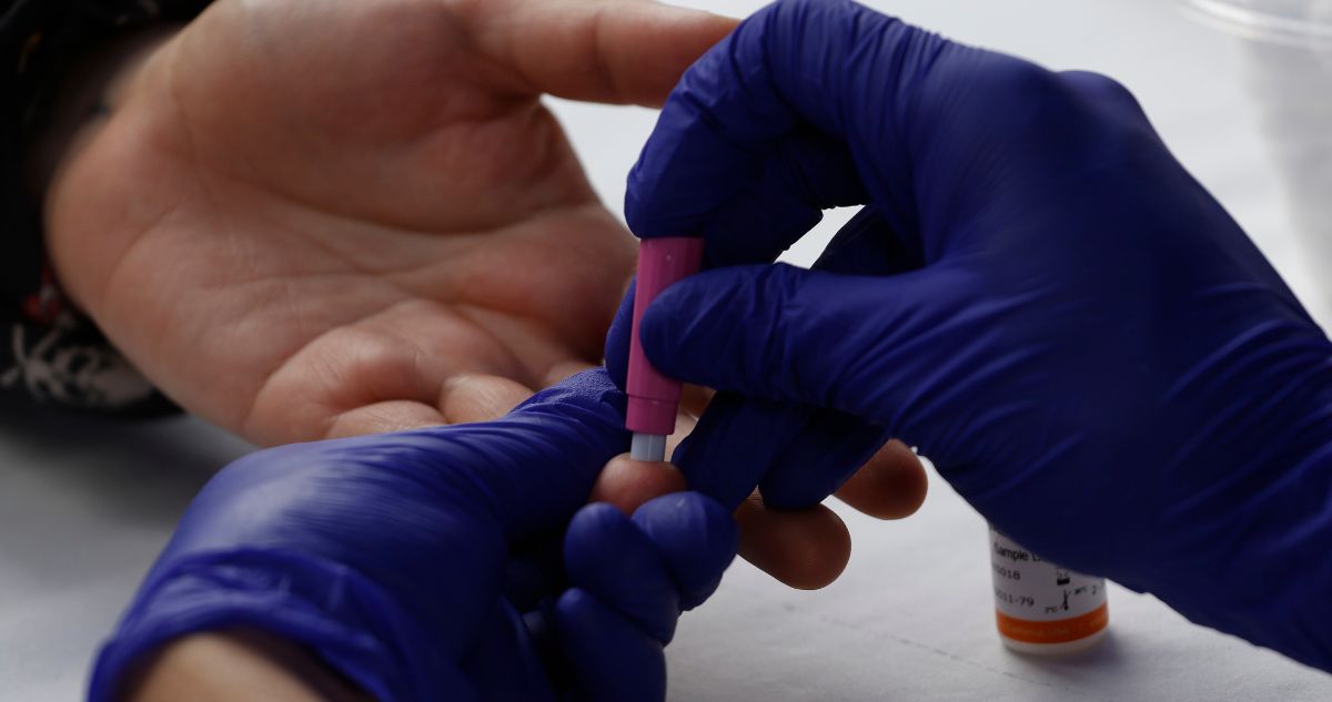 Alerta por VIH en Chile: más de 21 mil diagnosticados no reciben tratamiento