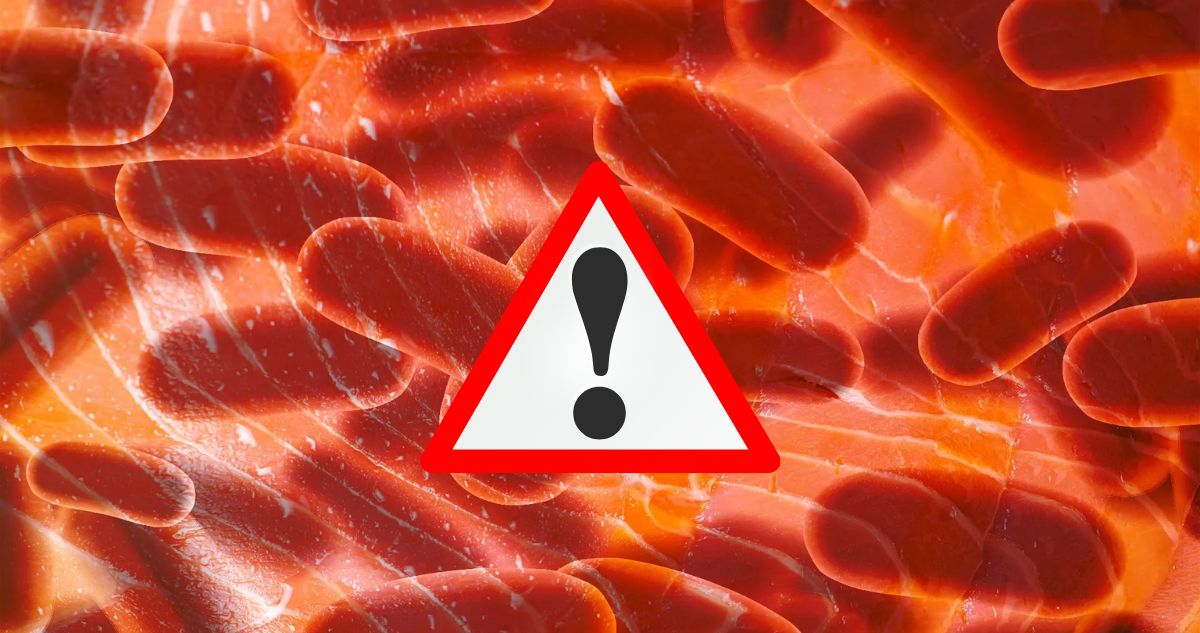 https://media.biobiochile.cl/wp-content/uploads/2026/09/listeria-chile.jpg
