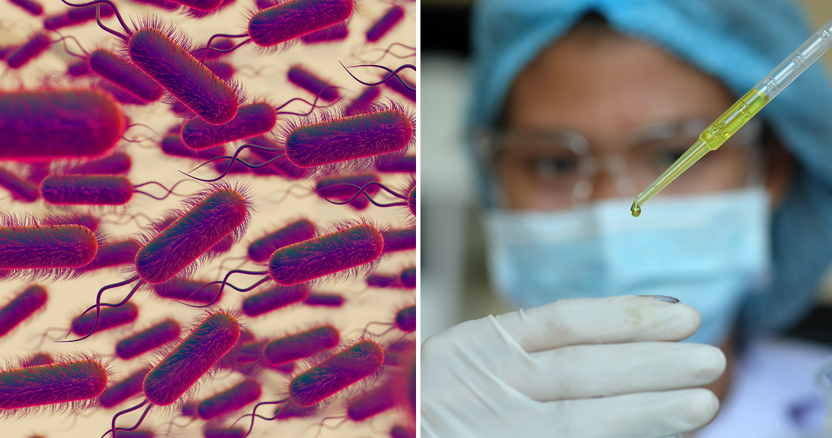 https://media.biobiochile.cl/wp-content/uploads/2026/09/listeria.png