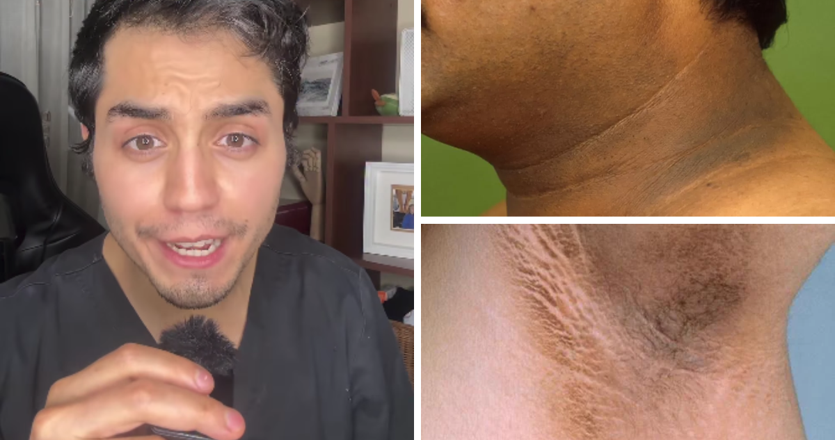 Dermatologo Gabriel Aedo y ejemplos de manchas oscuras en la piel