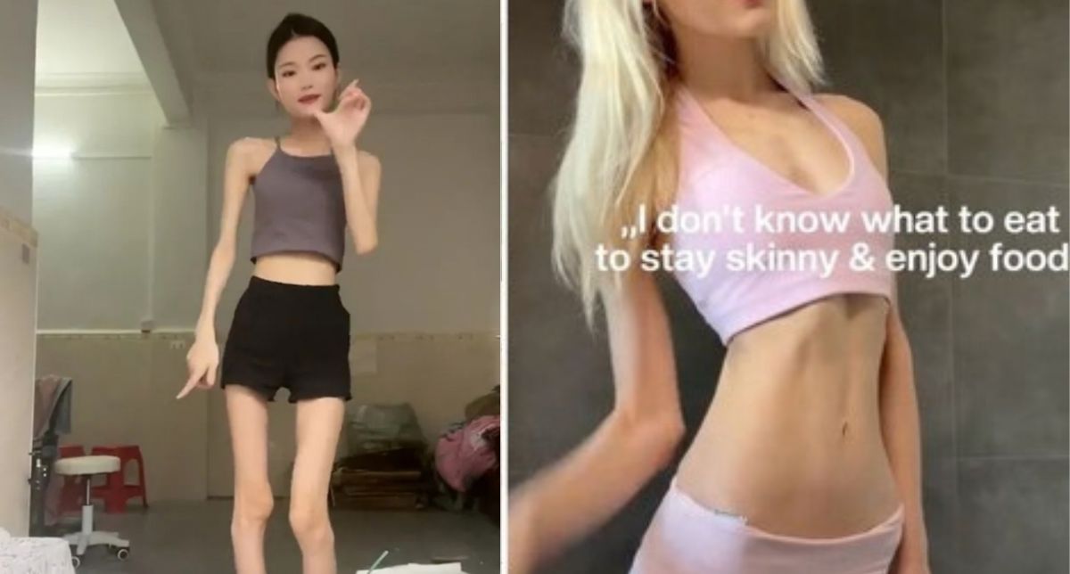 Los peligros ignorados del “SkinnyTok”: tendencia a la delgadez extrema que preocupa a especialistas
