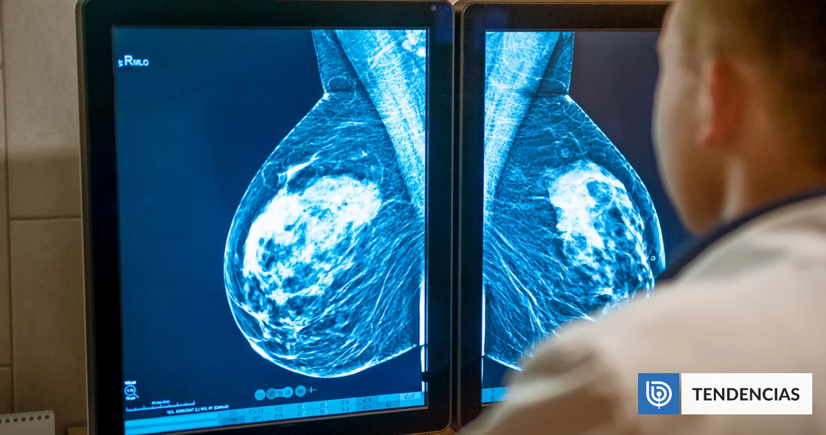 Mutilaciones y diagnósticos fallidos: el escándalo por casos de cáncer de mama que sacude a Inglaterra