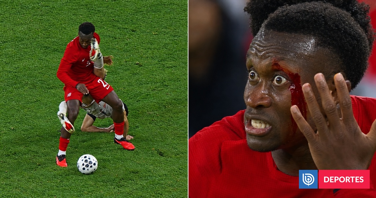 La roja a Lucas Cepeda en Canadá-Chile: golpeó con su zapato la cara de rival y lo dejó sangrando