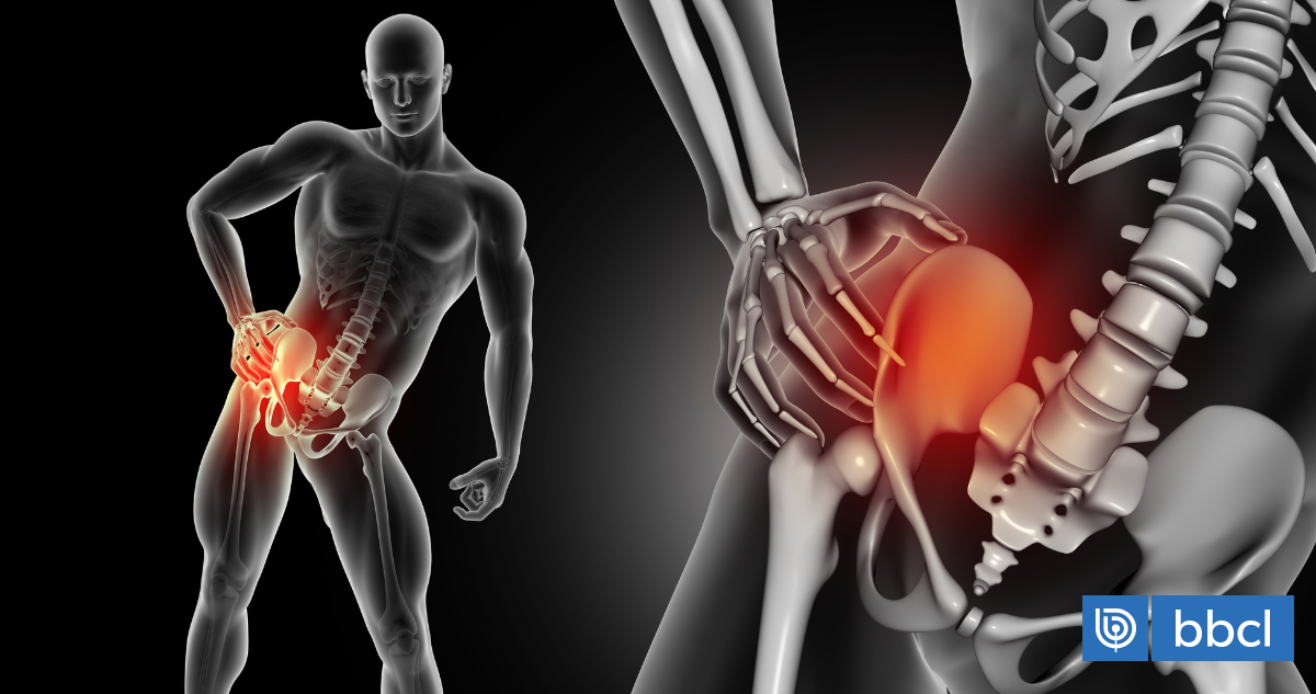 La pubalgia no es exclusiva del embarazo: en qué circunstancias ocurre y cómo tratarla