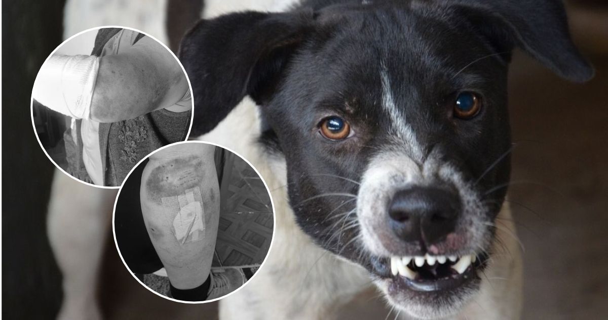 Jauría de perros ataca a adulta mayor en San Pedro de la Paz