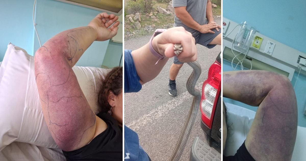 Las culebras chilenas SÍ son venenosas y esto es lo que puede causar una mordedura