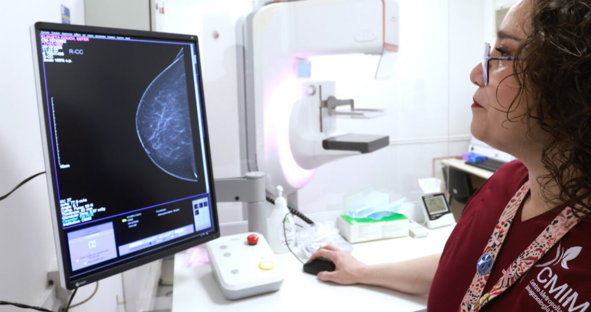 La nueva estrategia del Minsal para detectar el cáncer de mama en casos de alto riesgo