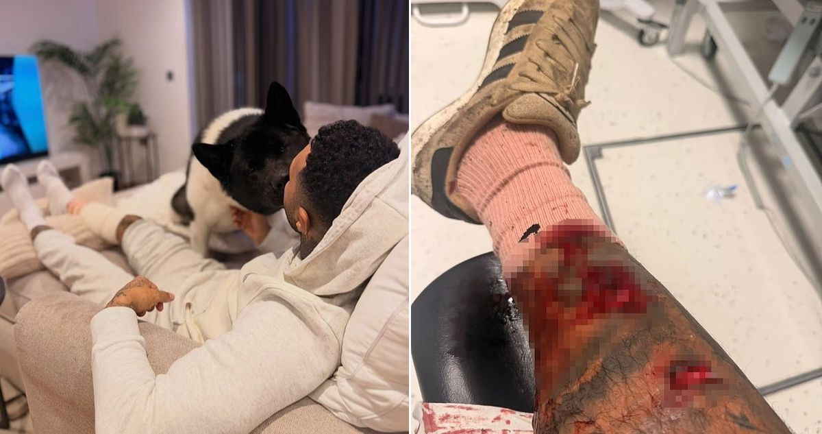 Exfutbolista de Liverpool, Jermaine Pennant, sufrió con ataque de perro