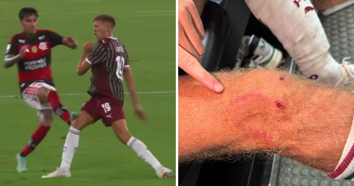 Fluminense se lanzó contra Erick Pulgar por patadón en clásico carioca.