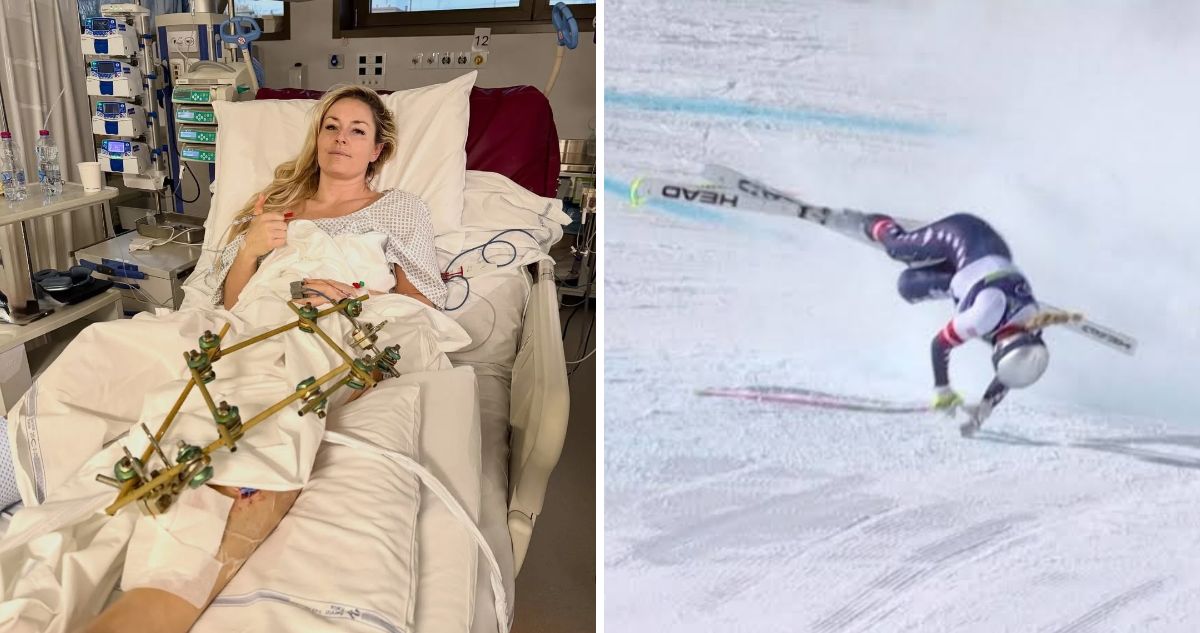 A meses de casi perder una pierna, Lindsey Vonn podría volver a competir.