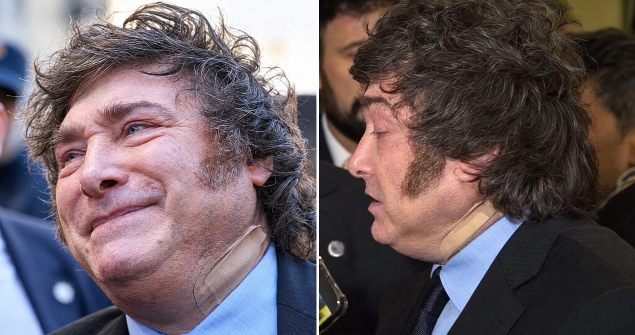 Javier Milei apareció con visible parche en España