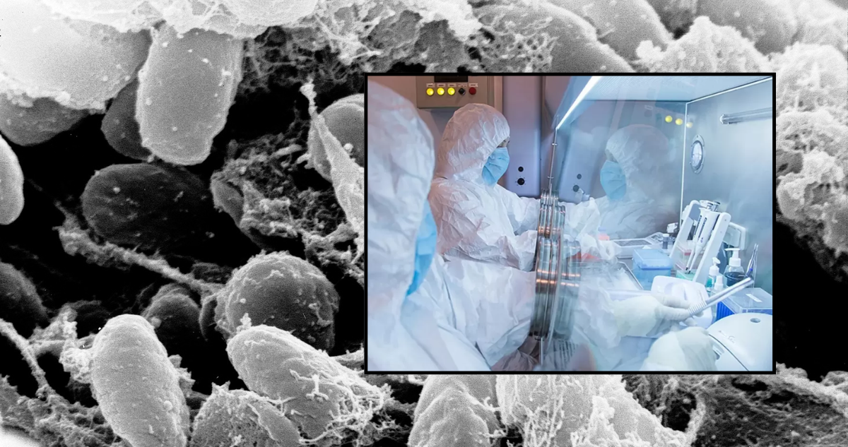 Peste neumónica – Yersinia pestis
