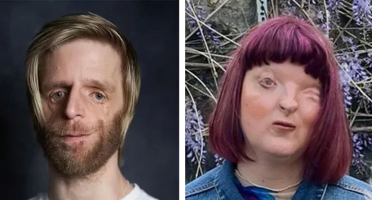 La BBC revela que la IA edita rostros de personas desfiguradas sin consentimiento para hacerlas normal