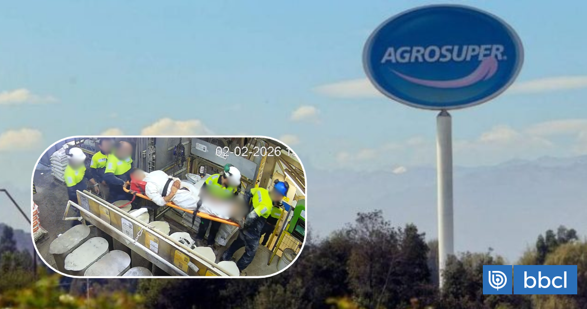 Trabajador perdió su pierna tras graves heridas con mezcladora y demandó por $600 millones a Agrosuper