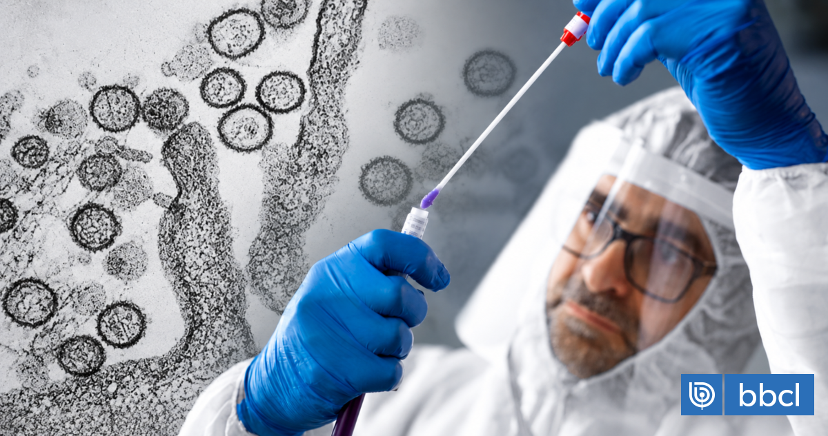 En medio de alerta sanitaria: así avanza test rápido para detectar hantavirus desarrollado desde UACH