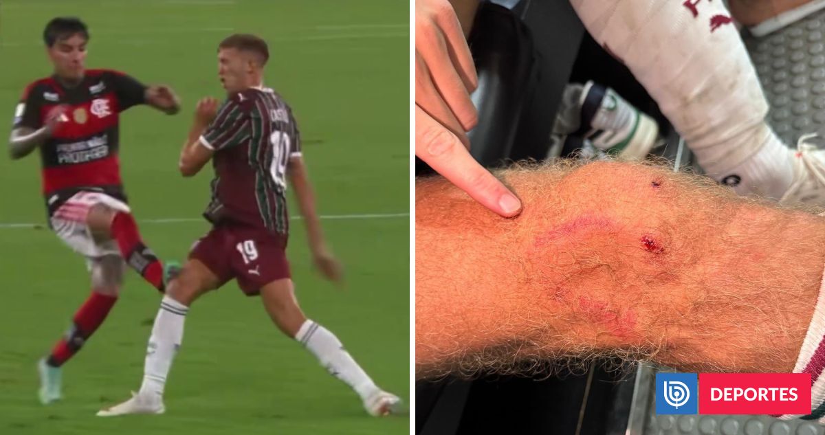 "Desleal" y "una amenaza": Fluminense se lanza contra Erick Pulgar y árbitros por 'patadón' en clásico