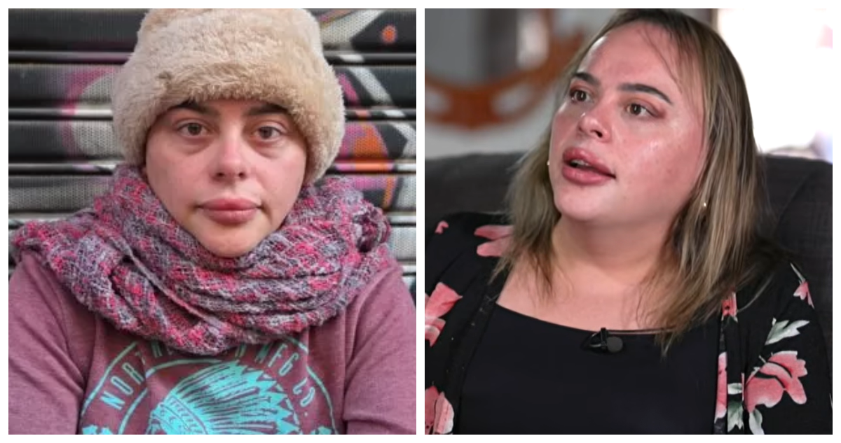 “Tengo un problema de alcohol”: exconcejala de Graneros rompe el silencio tras salir de la calle